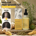 Lovocross Natural Hair Growth Oil
